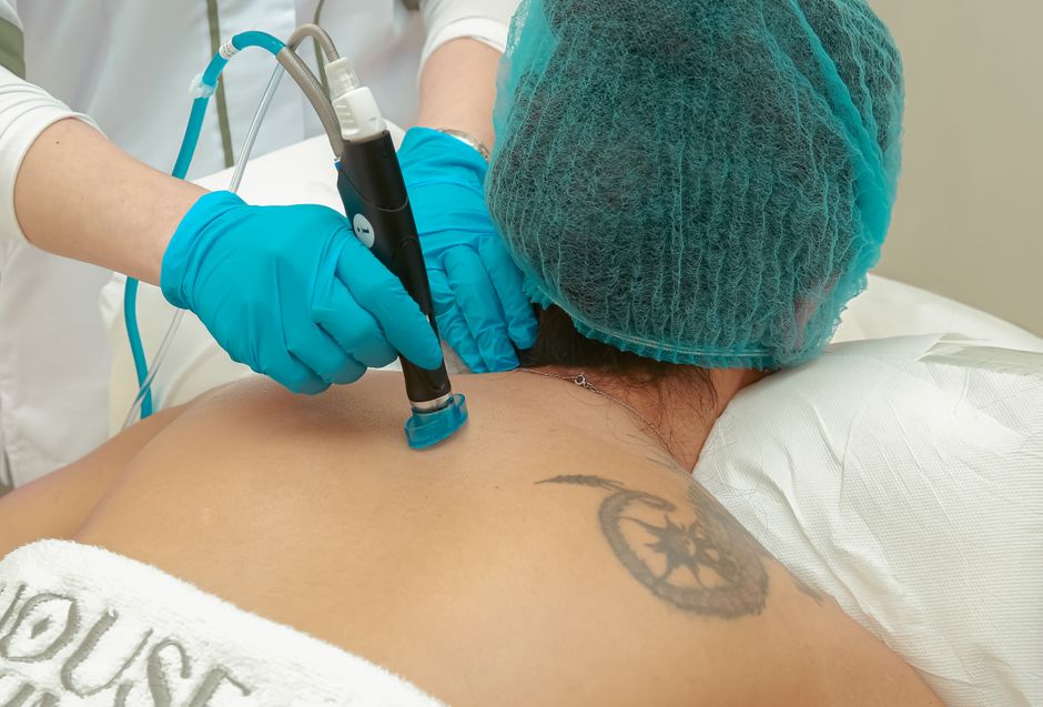 Cum sa te pregatesti pentru sedintele de epilare definitiva? Ce sa faci dupa fiecare sedinta?